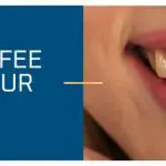 Does coffee stain your teeth