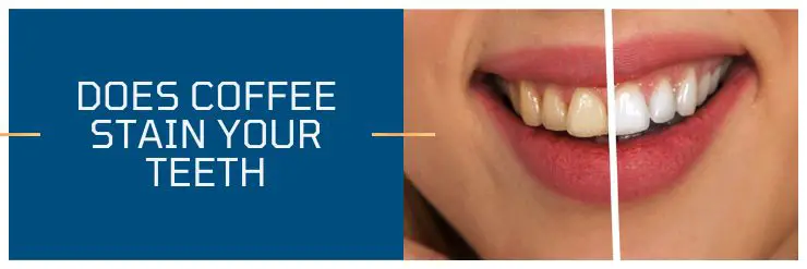 Does coffee stain your teeth