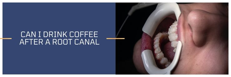 Can I Drink Coffee After a Root Canal